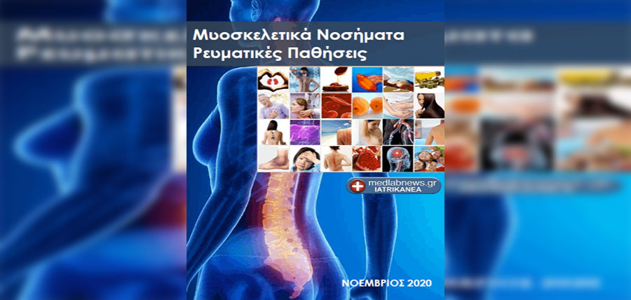 Νέο δωρεάν ηλεκτρονικό βιβλίο: Μυοσκελετικά Νοσήματα – Ρευματικές παθήσεις article cover image
