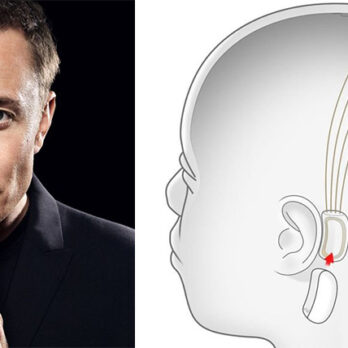 Elon Musk: Τσιπ στον εγκέφαλο, για να περπατούν παραπληγικοί cover image