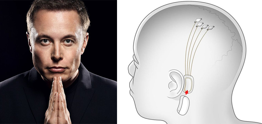 Elon Musk: Τσιπ στον εγκέφαλο, για να περπατούν παραπληγικοί article cover image