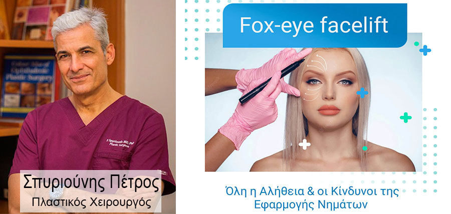 Fox-eye facelift. Όλη η αλήθεια & οι κίνδυνοι της εφαρμογής νημάτων article cover image