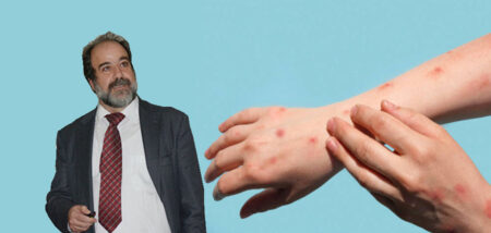 Το προφίλ του ιού της ευλογιάς των πιθήκων – Τι αναφέρει ο καθηγητής Χρήστος Χατζηχριστοδούλου cover image
