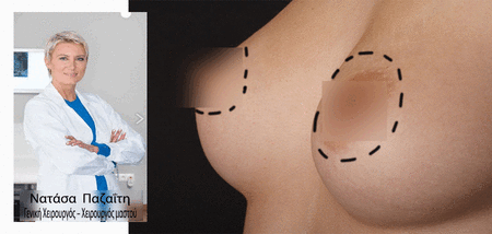 Καρκίνος του μαστού και αποκατάσταση cover image
